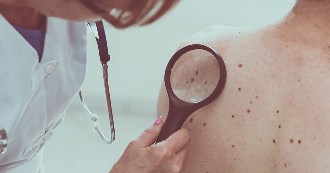 dermatologist using a device to examine the skin