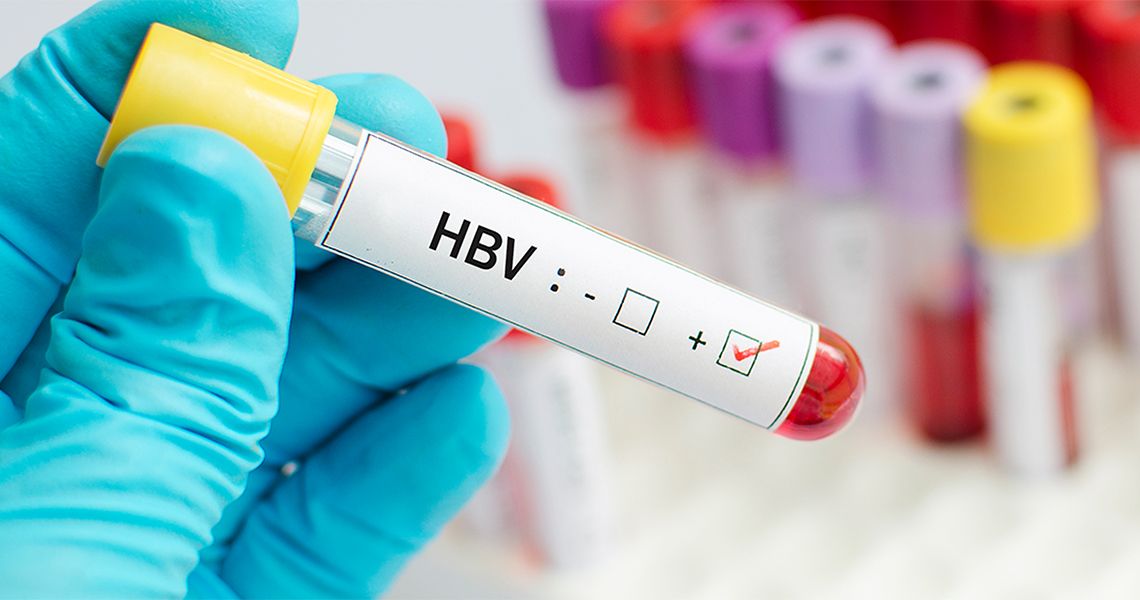 HBV vial