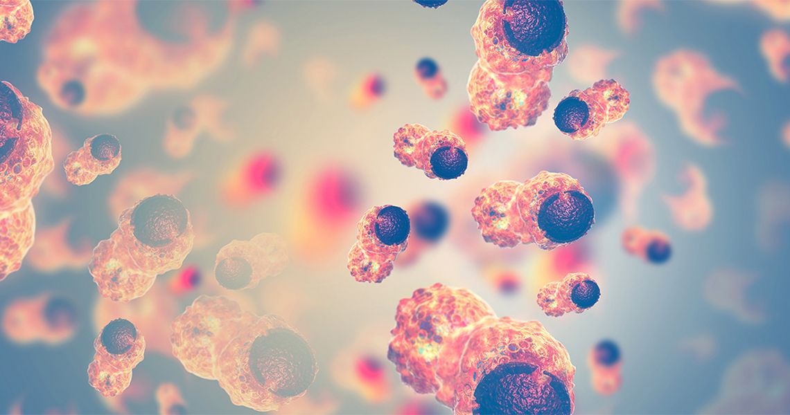 depiction of skin cancer cells